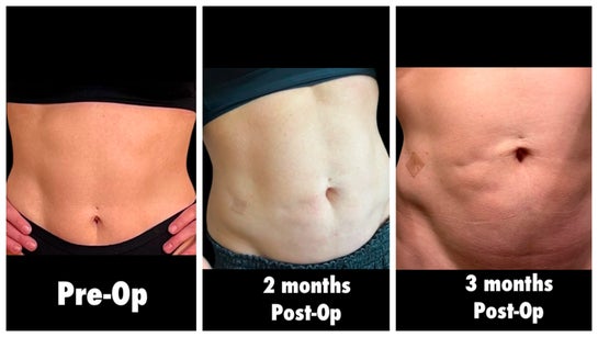 where to buy injection b12 online Buy Lipotropic B12 Injections Online for Metabolism Energy