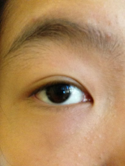 How to make double online eyelid more obvious