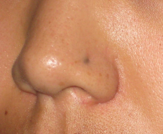 How to Remove Dark Spot from Silver Piercing