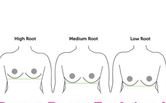 Breast are not saggy but low on body (Photo)