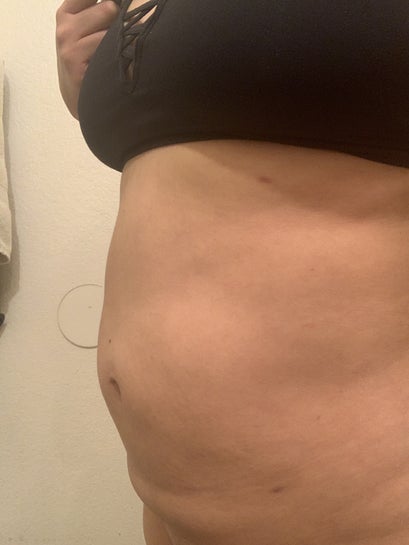 vitamin b12 injections in loachapoka B12 Lipotropic Injections
