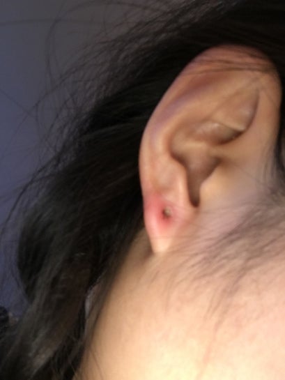 How to repair damaged ear piercings - The Washington Post
