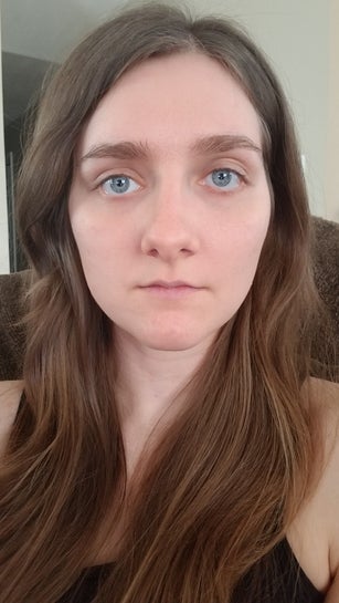 Uneven eyes deals