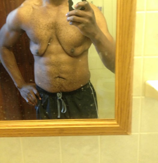Excess Skin on Pectoral and Abdominal Area After Weight Loss? (photo)