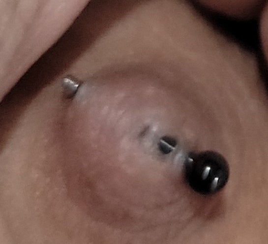 Nipple piercing rejection Will it scar Is surgery needed photos