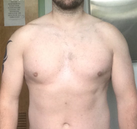 Is this gynecomastia? Please look closely and you will see my left breast  is bigger than the right. Any advice?? : r/gynecomastia