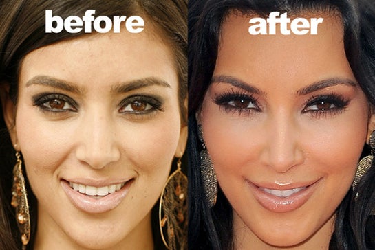 What Did Kim Kardashian Do To Her Eye Area I Want That Eye Shape She Has My Eyes Currently Look Like Her Before Pics Photo