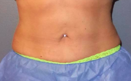 Larson Medical Aesthetics University Place University Place Washington Realself