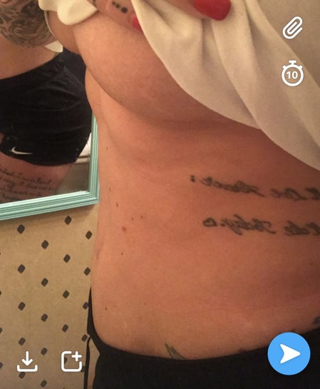 I have underboob, I'd like lipo in that area. I'm small. (Photos)