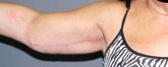 Sanctuary Plastic Surgery Boca Raton Boca Raton Florida Realself