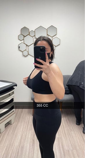 Is 385CC enough to get me to a D cup? 5'2, 140-150lbs? (photos)