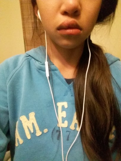 I Have A Really Droopy Left Bottom Lip What Can I Do For It Photo