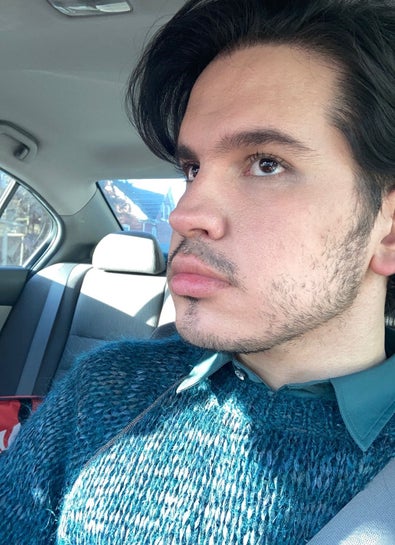 What Do You Advise To Achieve More Definition On The Lower Side Of My Face Photos