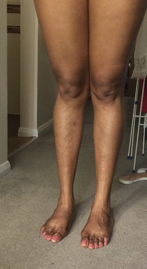 Thick thigh, Skinny Legs. Any suggestions? (photos)