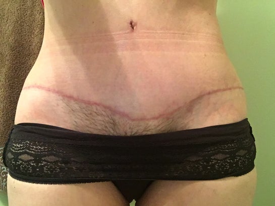 Crooked sales belly piercing