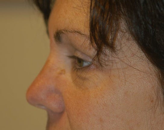 Piedmont Plastic Surgery Dermatology Gastonia 959 Cox Rd Gastonia North Carolina Realself