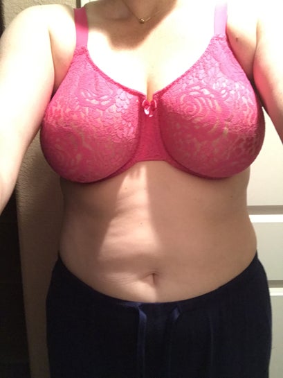 Surgeon recommended a breast lift over reduction. I'm 36G and want to be a  small C. Is this achievable with a lift? (Photos)