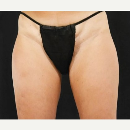 Ladies G-String Disposable Panties, Black - 30368