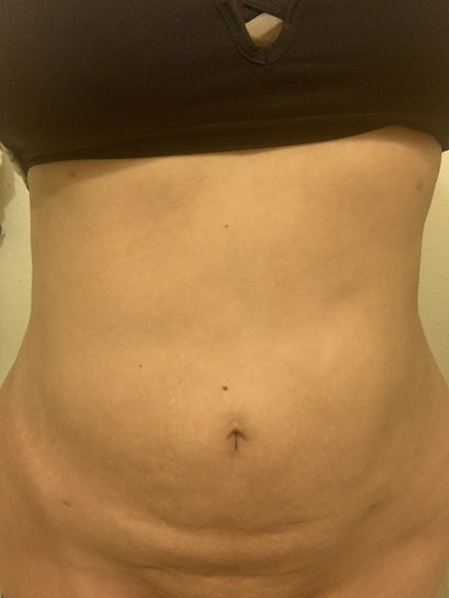 goldpharma b12 injections Boost Energy and Wellness with Rx B12 Injections