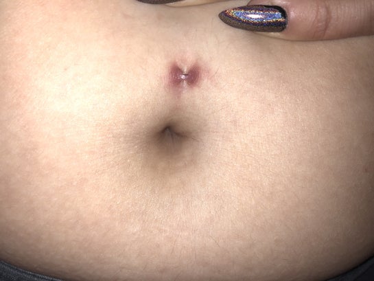 Irritated belly cheap button piercing