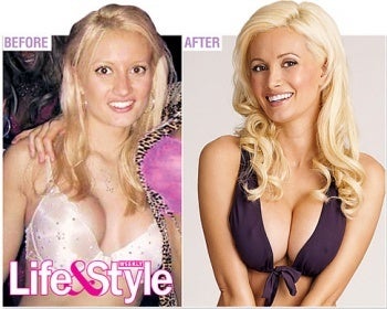 What Did Holly Madison Do To Make Her Eyes Look Smaller What Kind Of Surgery Makes Your Eyes Less Bulbous Photos