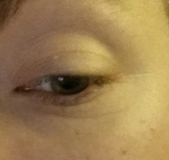 fine lines around eyes in 20s