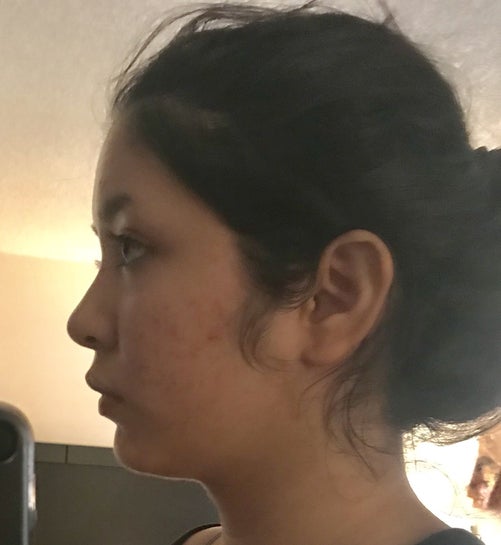 What can I do to have a better side profile? (Photo)