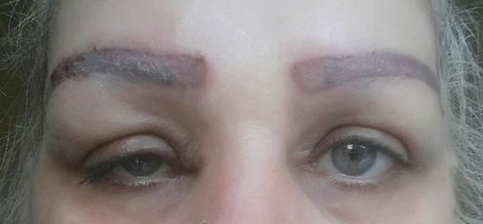 Laser Eyeliner Tattoo Removal and Laser Brow Tattoo Removal in in Phoenix  Arizona | Sherry Corvino Beaute Solutions