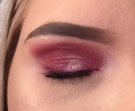 wrinkly eyelids at 18