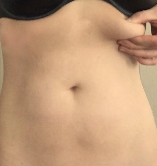 Fat under breasts, on top of ribcage. Tried diets/exercise, won't