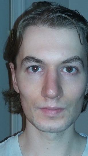 Is My Lower Third Base Of Nose To Chin Too Short Compared To The Rest Of My Face Photo,Hand Drawn Line Png