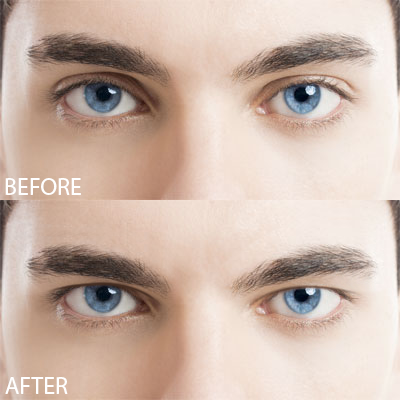 Low eyebrows clearance