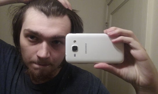 Is My Hairline Receding Or Maturing Photo