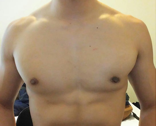 Is this gynecomastia? Please look closely and you will see my left breast  is bigger than the right. Any advice?? : r/gynecomastia