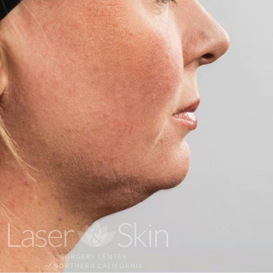 Laser Skin Surgery Center of Northern California Sacramento