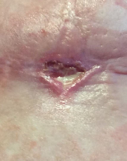 置物 the wound does not heal 創傷治癒アッセイキット | CytoSelect 24-well Wound Healing Assay