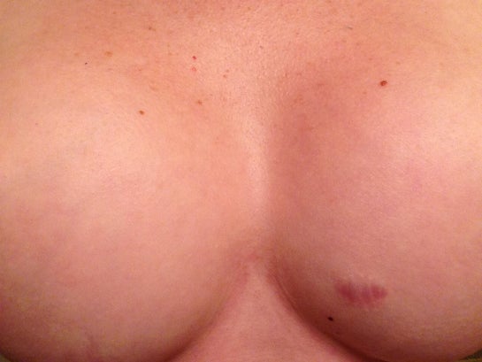 How Can You Enhance the Size of Your Breasts Without Using Implants? -  Frank Agullo, MD