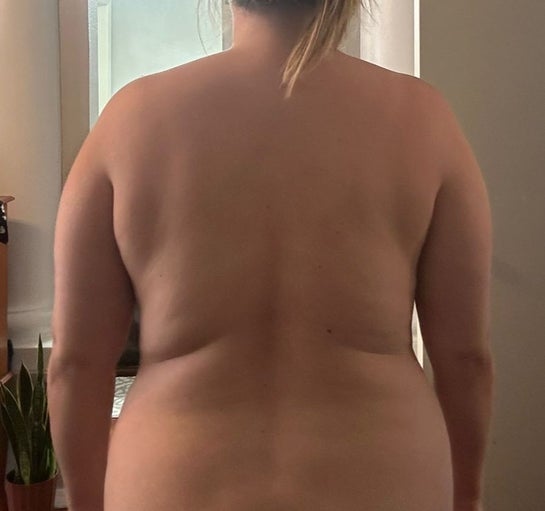 userimage 360 doc nude:2 