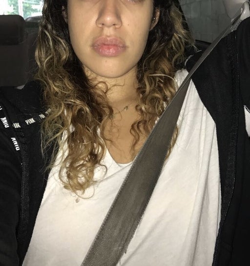 I have a long narrow face that's starting to become more bottom heavy and  lacks dimension. What do you suggest? Fillers? (photo)