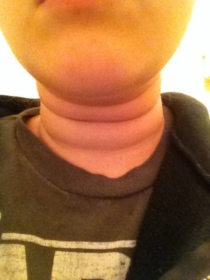 Neck with deals rolls