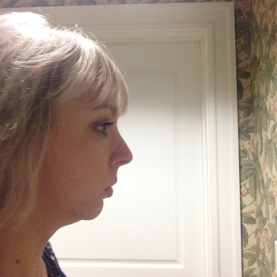 Weak Chin Side Profile Female