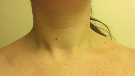 கழுத்து கோடுகள் இல்லாமல் போக உதவும் பயனுள்ள குறிப்புக்கள் 8 How Can I Address Deep Neck Creases? In My Early 20's.