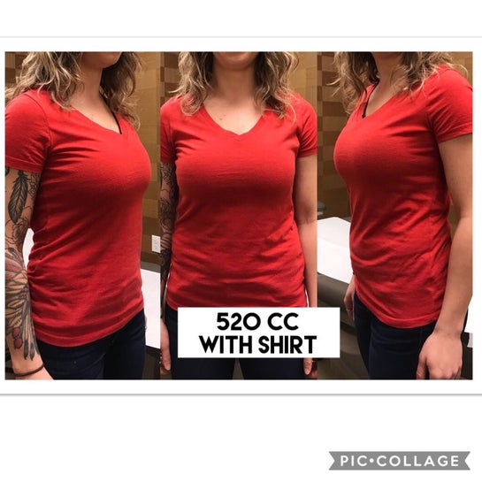 Cc 520 2025