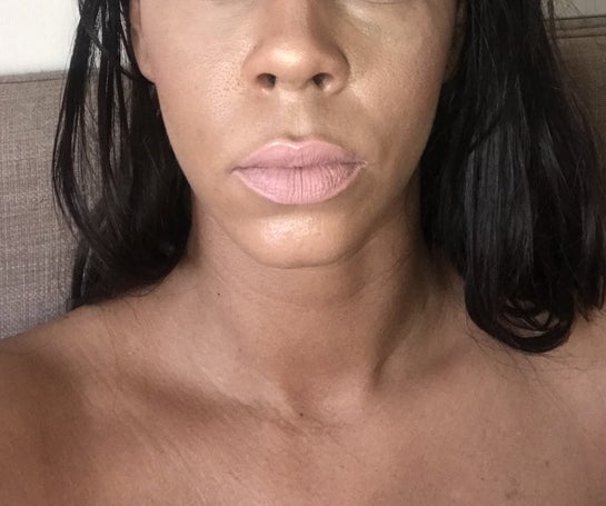 Is 35 Too Young For A Facelift Photo