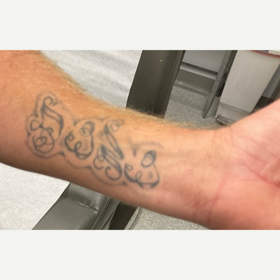 The doctor giving gang members a fresh start by removing their prison  tattoos for free | The Independent | The Independent