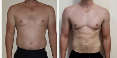 35-44 year old man treated with Semaglutide, Evolve - Treatment of Evolve Muscle + Semaglutide Combo