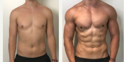 25-34 year old man treated with Evolve, Semaglutide - Treatment of Evolve Muscle + Semaglutide Combo
