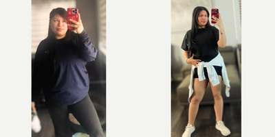 Woman treated with Gastric Sleeve Surgery - Congratulations on your great achievement; 41 pounds down in 2 months.Keep going with that enthusiasm and commitment to reach the goal you have set for yourself.