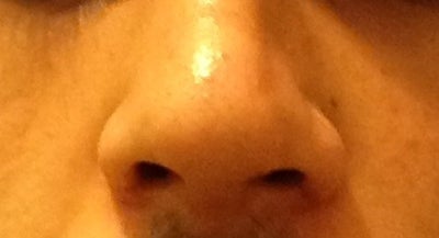 I can feel irregular cartilage on my nose. Is it something that will go