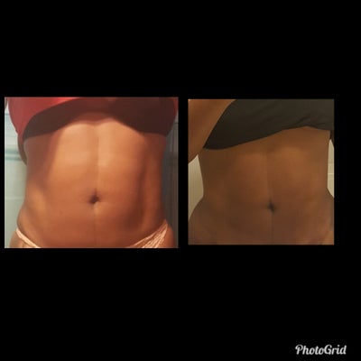 Vive discount plastic surgery